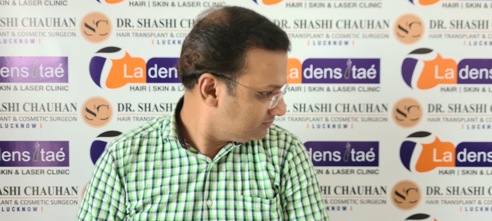 Rahul Agrawal After Hair Transplant